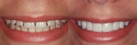 see a dentist for healthy teeth-Dentist in Atascadero