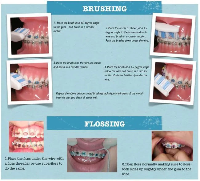 cleaning procedure